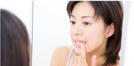 歯が欠けている・ヒビが入っている